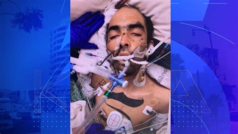 Hospital seeks help identifying patient found in Los Angeles County